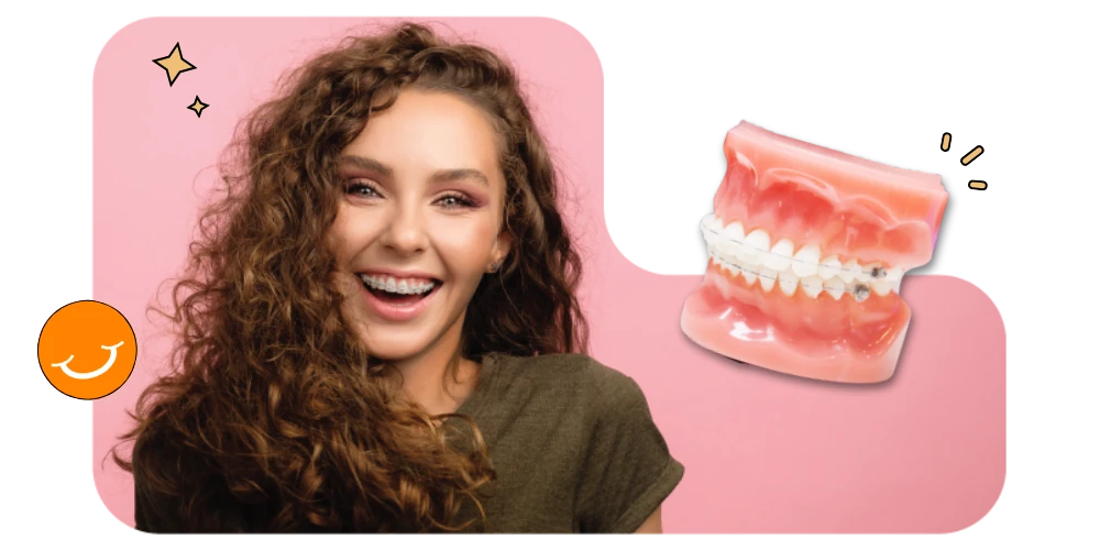 Ceramic Braces Clear Braces